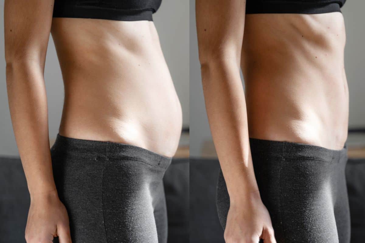 Post-Pregnancy: What Happens to Your Abdominal Muscles After Birth Sedgley Park