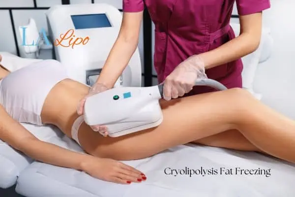Woman receiving coolsculpting Sedgley Park treatment on her thighs