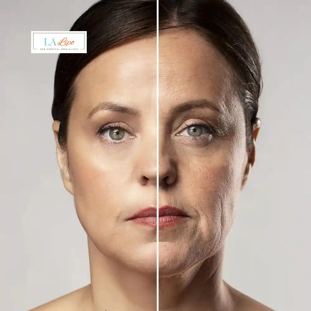 How Can You Tell If Non-Surgical Skin Tightening Is Right for You Sedgley Park?