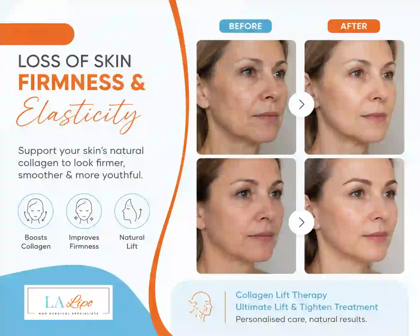 Sign #7: Loss of Skin Firmness and Elasticity Sedgley Park